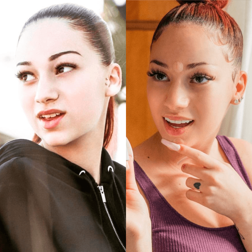 on the left danielle wihtout teeth veneers. right side danielle with teeth veneers, straight white teeth