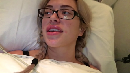 Anastasia often has Lip Injections.