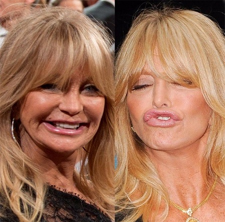 Another before and after comparison of Goldie Hawn's plastic surgery rumors.