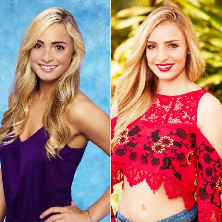 Lead Block  Before and After photo after surgery.