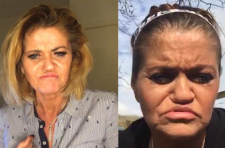 Danniella Westbrook had a rib insertion procedure in 2018 after osteoporosis ruined her cheekbones and gums.