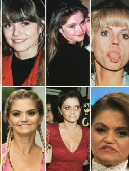  Danniella Westbrook took to Instagram on Tuesday to share the results of her recent nose surgery.