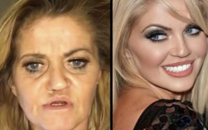 Danniella Westbrook Reveals About her Nose Surgery