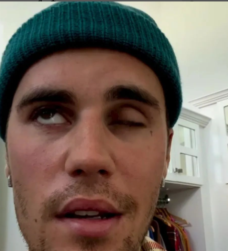 Justin Bieber has gone viral, but not in a good way. 